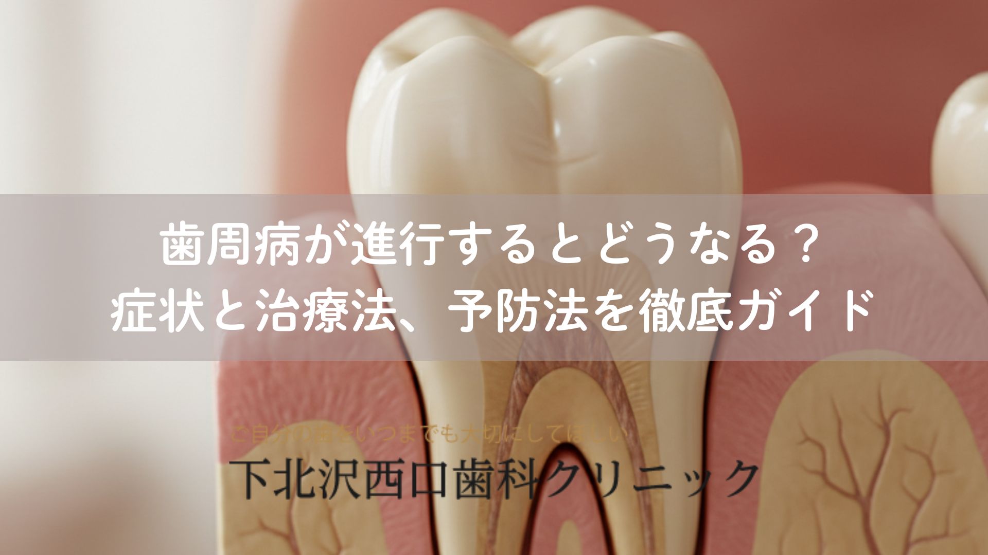 歯周病が進行するとどうなる？症状と治療法、予防法を徹底ガイド