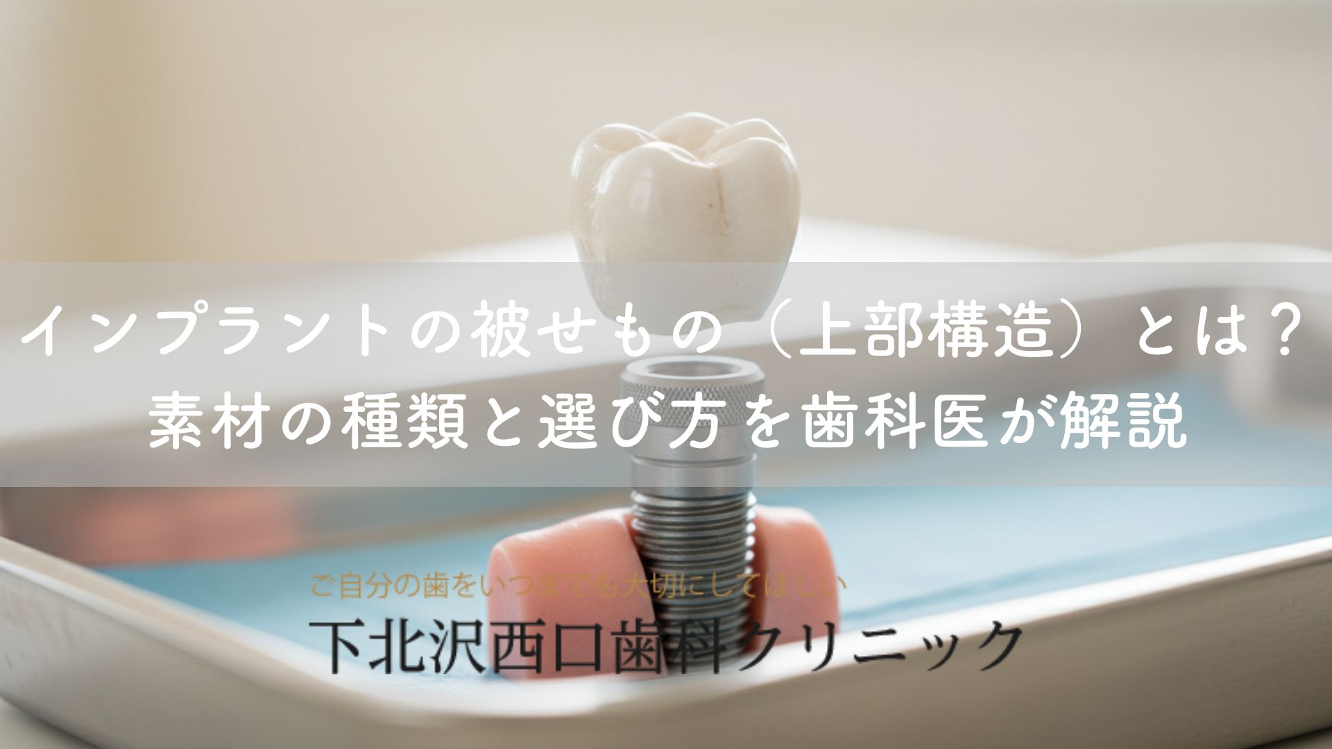 インプラントの被せもの（上部構造）とは？素材の種類と選び方を歯科医が解説